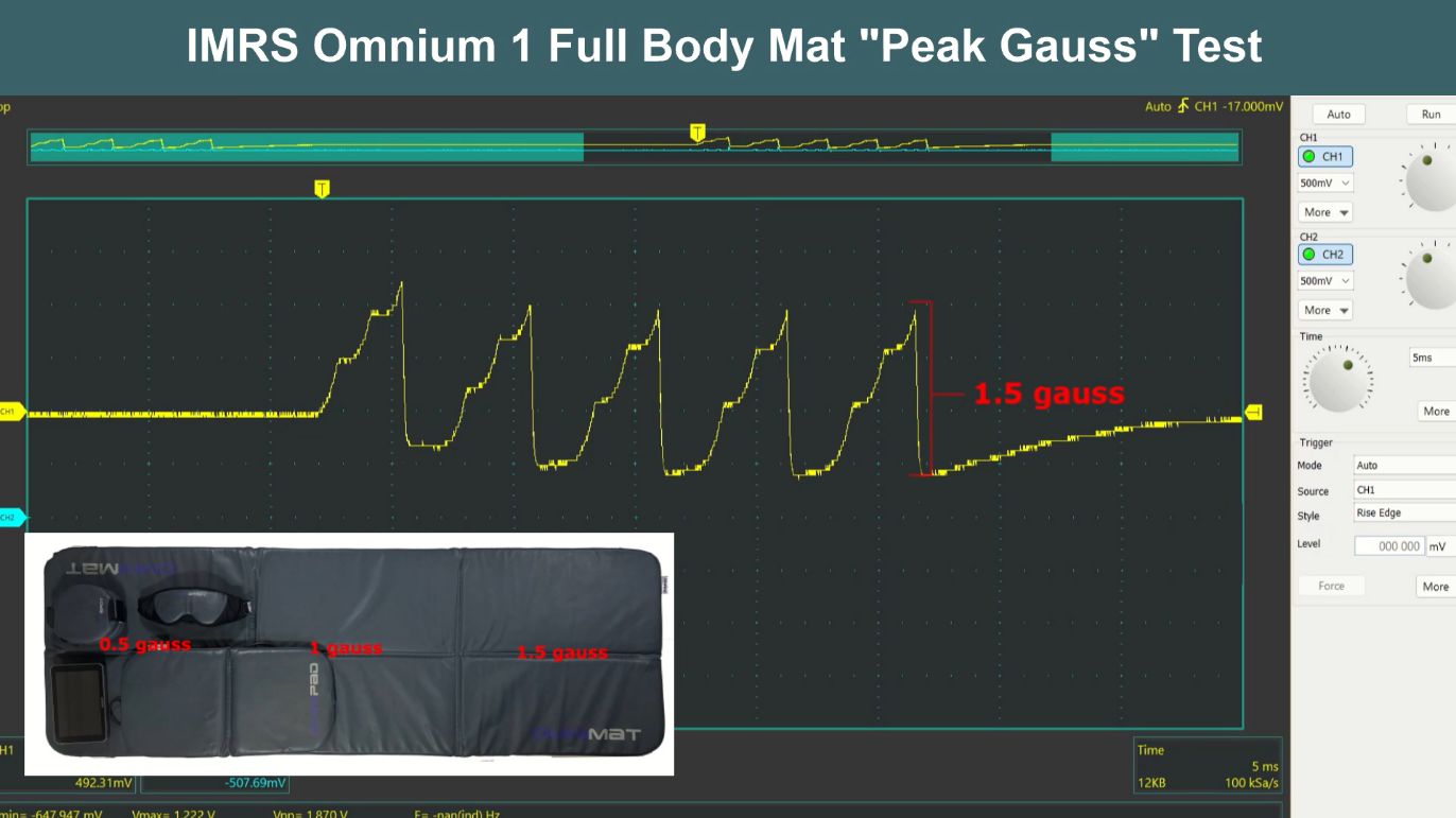 IMRS intensity 1.5 gauss